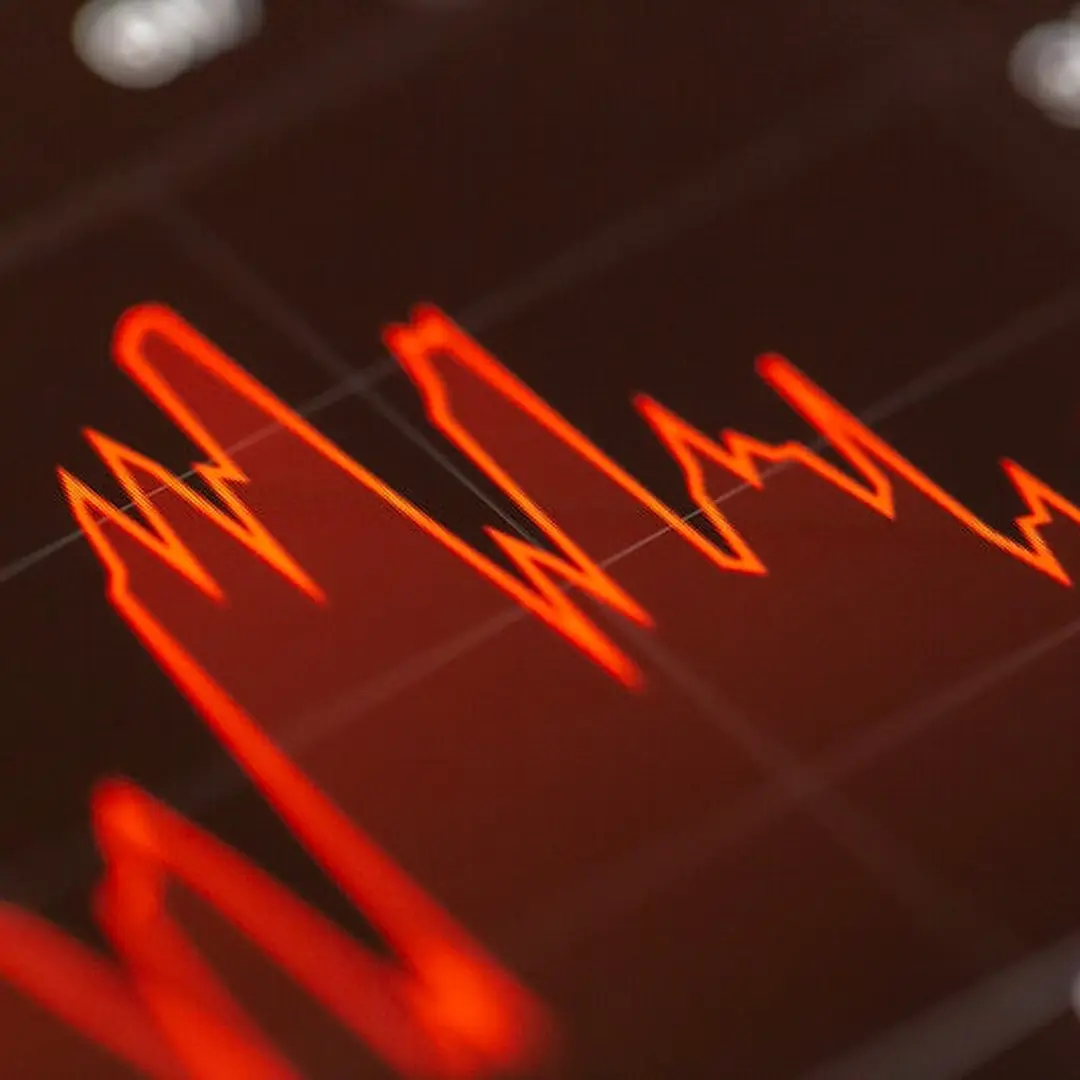 Nasdaq Loses $1T as Intel Hits Worst Day in Histor